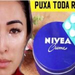 ACABE-COM-SUAS-RUGAS-E-MANCHAS-COM-APENAS-1