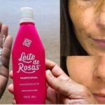 Como-acabar-com-manchas-e-rugas-em-poucos-dias-1