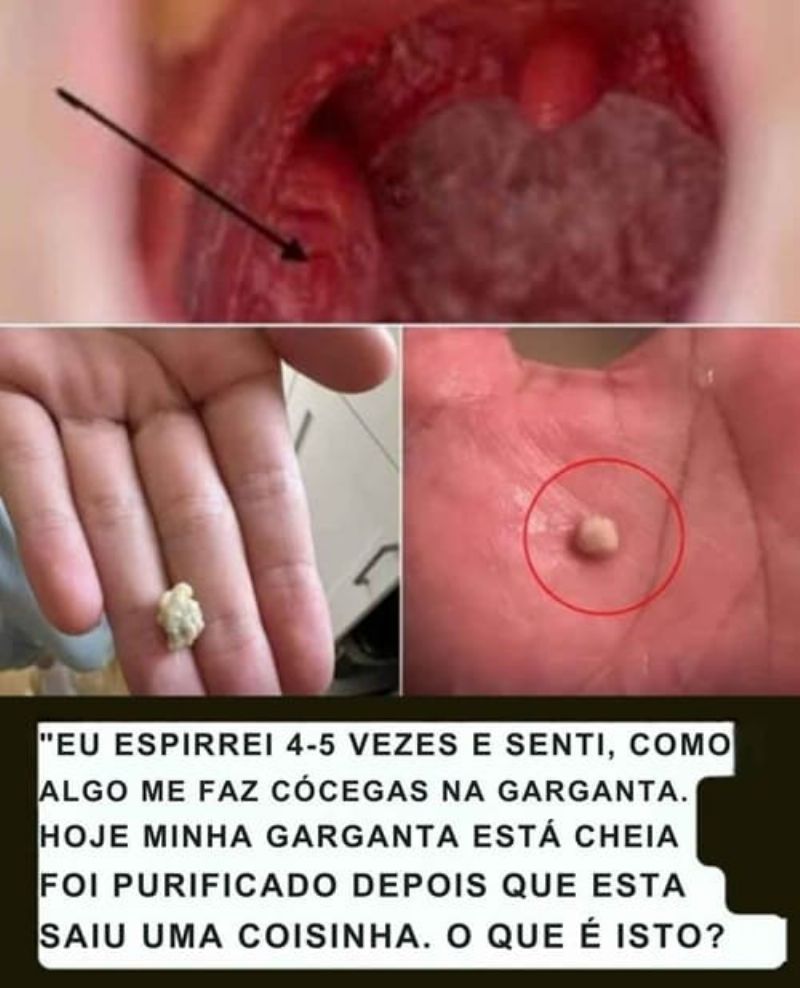 Imagem da Receita