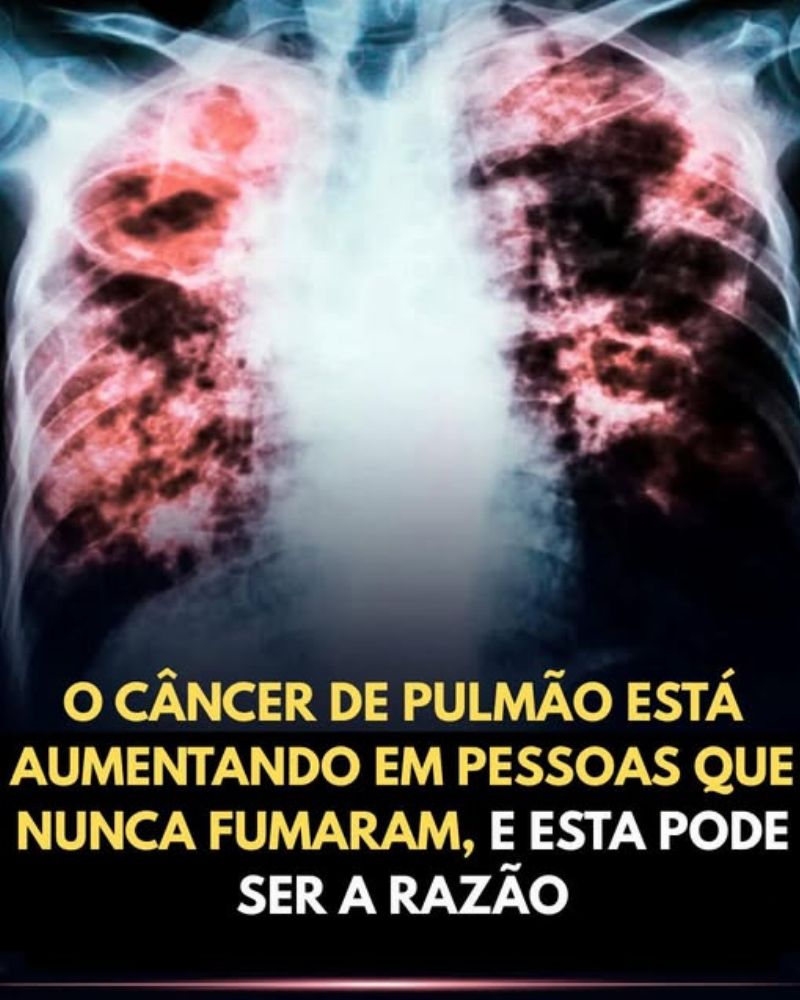 Imagem da Receita